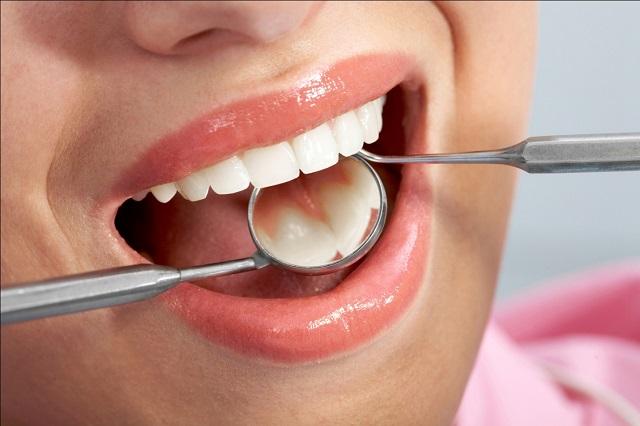 Cách chữa đau răng sâu nhanh chóng nhất là bạn nên cơ sở nha khoa để khám và điều trị