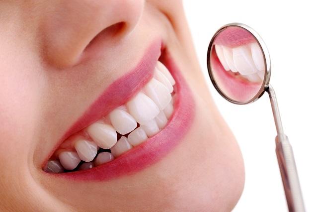 Bệnh sâu răng là gì?