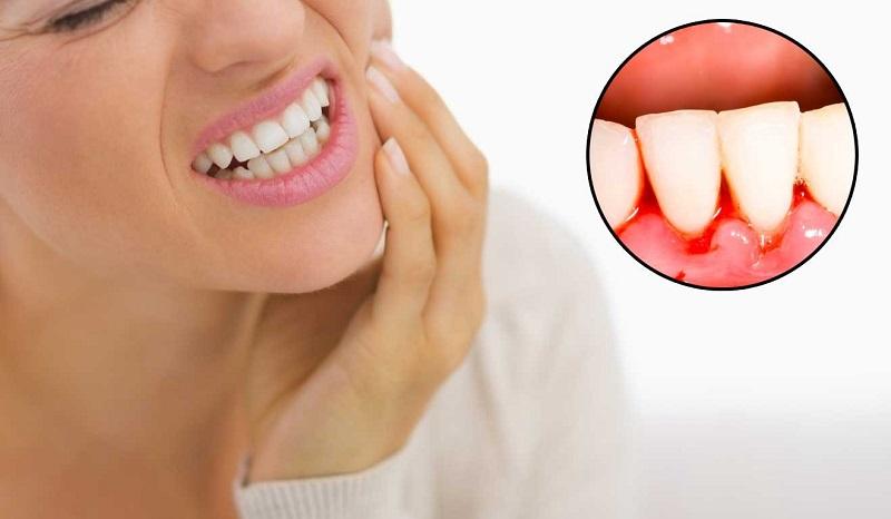 Việc dùng chỉ tơ nha khoa không đúng cách sẽ dẫn đến nhiều hệ lụy tổn thương đến răng